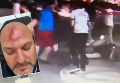 100 bin lira kira talebini reddeden kiracıya beyzbol sopalı saldırı güvenlik kamerasına yansıdı