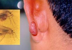 Doç. Dr. Kavur: Kan emen kum sineği dalakta ve karaciğerde büyümeye neden oluyor