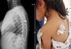 Site bahçesinde oynayan Meliha, sırtına isabet eden yorgun mermi ile vuruldu