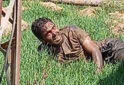 Şanlıurfa'da kuduz hastası hastaneden kaçtı, vatandaşlar paniğe kapıldı