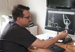 Ölümcül beyin anevrizmasıyla ilgili yeni keşif