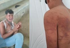 Ahırda zincirli işkence iddiasında, baba, amca ve ağabeye gözaltı
