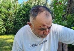 Restoran sahibine dambıl barı ile saldırı; çalışanları 100 bin lirasını gasbetti