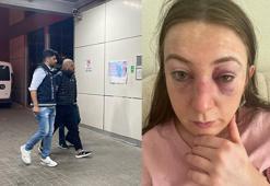 Sibel'i dövüp, ölümle tehdit eden eski sevgilisi tutuklandı