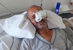 Elektrikli testere yüzünü kesti; gözünü kaybetme riski var