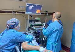 Rize'de 'endoskopik ultrasonografi cihazı' eğitimi verilirken hastalara da teşhis koyuldu