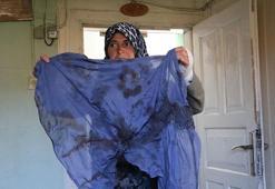 Köyde hayvanları otlatma kavgasında darbedildi