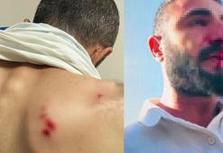 Kaçak elektrik kontrolü yapan ekibe odun ve yumruklu saldırı: 2 yaralı