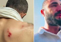 Kaçak elektrik kontrolü yapan ekibe saldıran 2 şüpheli gözaltına alındı