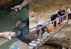 Tarihi kalenin dehlizine düşen doktora ilk müdahale, cep telefonu ışığında yapıldı