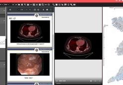 Ankara Üniversitesi'nden yerli ve milli patoloji yazılım programı