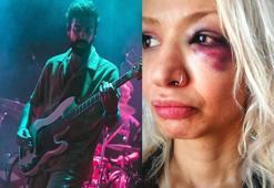 Yüzyüzeyken Konuşuruz'un gitaristine sevgilisini darbettiği iddiasıyla soruşturma