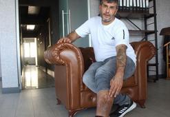 Bacağında unutulan bez parçasıyla 16 yıl yaşadı