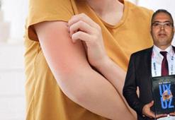 Prof. Dr. Durdu: Son 3- 4 yılda uyuz vakaları 30- 40 kat arttı