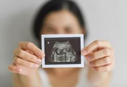 “Kadınlarda 37 yaş sonrası yumurtaların yüzde 90’ı tükeniyor”