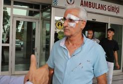 Park kavgasında taksici, öğretmeni dövdü