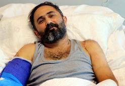 İş kazasında makineye sıkışan kolları mikrocerrahi ile kesilmekten kurtarıldı