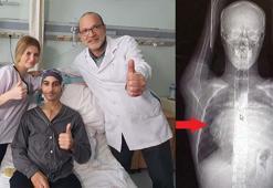 Kalbini 12 santim sağa kaydıran 6.5 kiloluk dev tümör doktorlarını bile şaşırttı