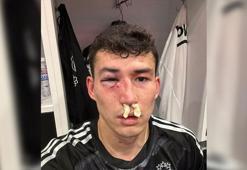 Zaynutdinov hastaneye kaldırıldı