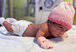 515 gram doğan Elif bebek, 98 günlük tedavi sonrası hayata tutundu