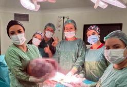 Karın şişliği için gitti, vücudundan 20 kiloluk kitle çıkarıldı