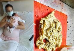 Doğumda annenin vücudunda gazlı bez unutulmasına inceleme