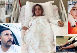 Eski nişanlının yüzüne kimyasal atmaya 15 yıl hapsin gerekçesi: Canavarca hisle yapıldı