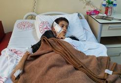 Sokak köpeğinin yüz, el ve kalçasından ısırdığı Veysel'i, komşuları kurtardı