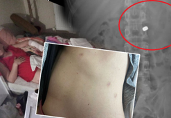 Sevgilisi tarafından 7 kurşunla yaralanan kadın DHA'ya konuştu: Cehennemi yaşadım