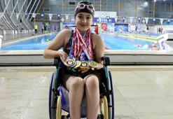 Kas hastası Ayşegül, bacaklarını geliştirmek için başladığı yüzmede 23 madalya kazandı