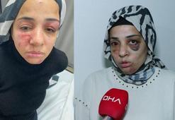 Bağcılar'da eski eşinin ailesi tarafından sokak ortasında dövülen kadının yardım çağrısı