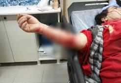 Yasaklı ırk köpeğin saldırısına uğrayan kadın yaralandı