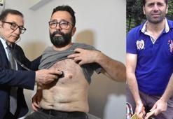 Nakil kalbe 25 yıl sonra baypas ameliyatı