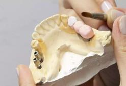 “Bilgisayar başında uzun çalışma, diş sıkmaya yol açıyor”