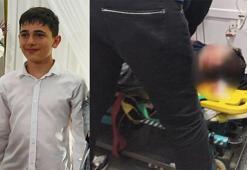 Büyükçekmece'de sac büküm makinesine kafası sıkışan çocuk yaşam savaşı veriyor