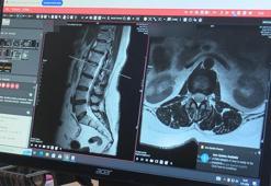 Kronik bel ağrısı çekecek hastayı ‘kan değerlerinden tanıyan’ çalışma