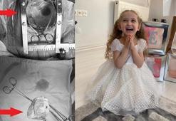 Minik kalbini 'söküp' tümörü temizleyip tekrar yerleştirdiler