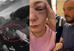 Eski sevgilisi Sibel'in vücudunda sigara da söndürmüş