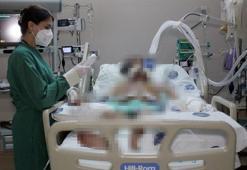 'Yoğun bakımda hasta hangi virüsle enfekte olursa olsun zatürre tedavisi yapıyoruz'