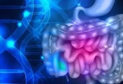 Bağırsak kanserinden ölüm, trafik kazasından ölümlerin 2 katından fazla