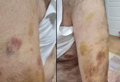 Büyükçekmece'de 'Otizmli öğrenciyi öğretmeni darbetti' iddiası