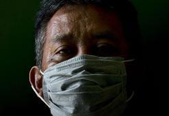 ABD’li yetkililer ‘hıyarcıklı veba’ vakasını doğruladı