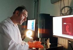 Dünya tıp tarihine geçecek çalışmalarda Türk imzası