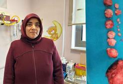 Rahminden 16 tümör çıkarıldı