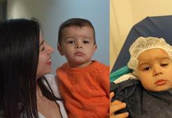 17 aylık Beste bebek, göz kapağı kaldırma ameliyatı ile sağlığına kavuştu