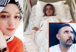 Eski nişanlının yüzüne kimyasal atmaya 15 yıl hapis az bulundu; karar bozuldu