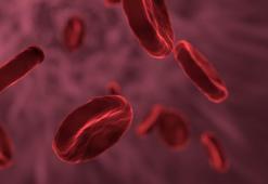 Bilim insanları, hücreden AIDS’e neden olan HIV virüsünü makas gibi kesip attılar