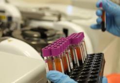 Karabük İl Sağlık Müdürlüğü'nden HIV ve HPV pozitif vakalarında artış iddiasına yalanlama