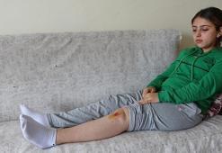 Liseli Özge, köpeklerin saldırısında yaralandı