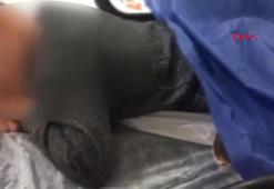 Kartal'da sokak köpeklerinin saldırısına uğrayan 7 yaşındaki Çağrı'ya 30 dikiş atıldı